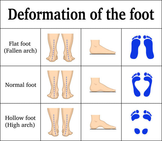 How to choosing running shoes Based on Your Running Style