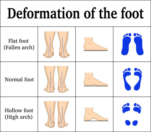 How to choosing running shoes Based on Your Running Style